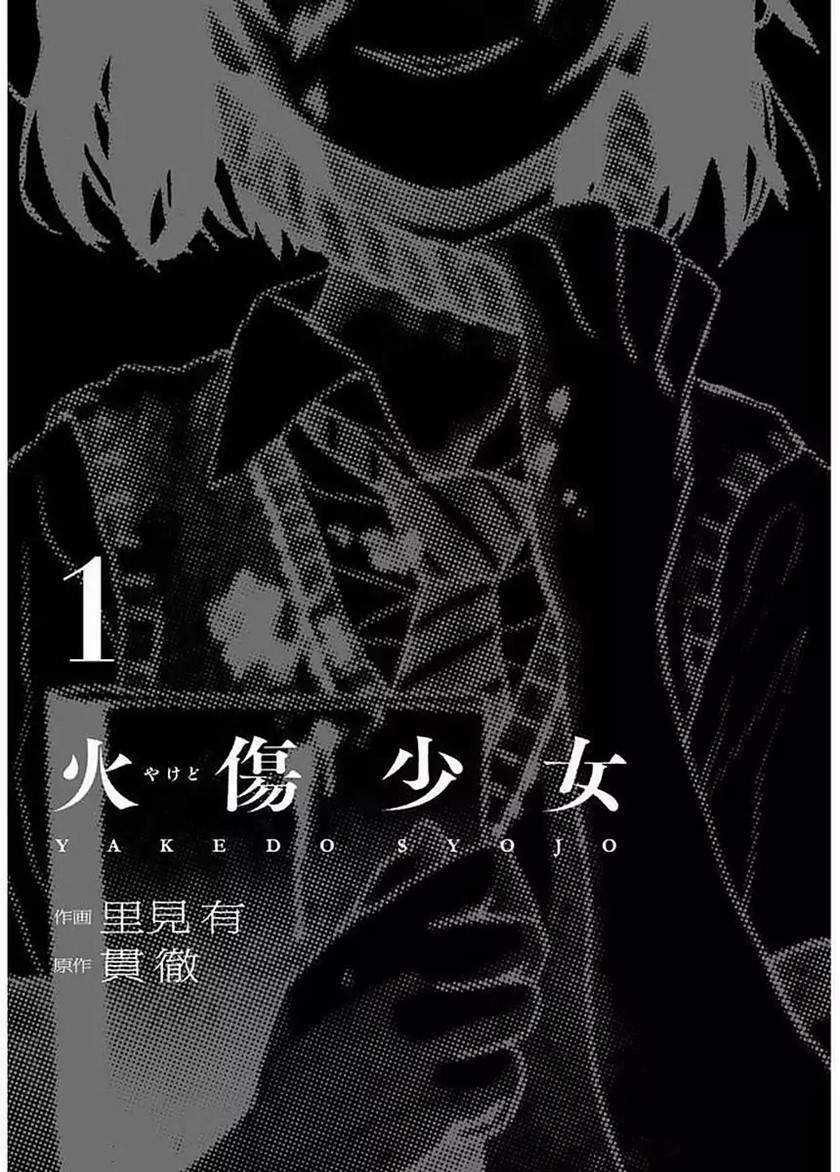 Yakedo Shoujo Bab 01 halaman 3