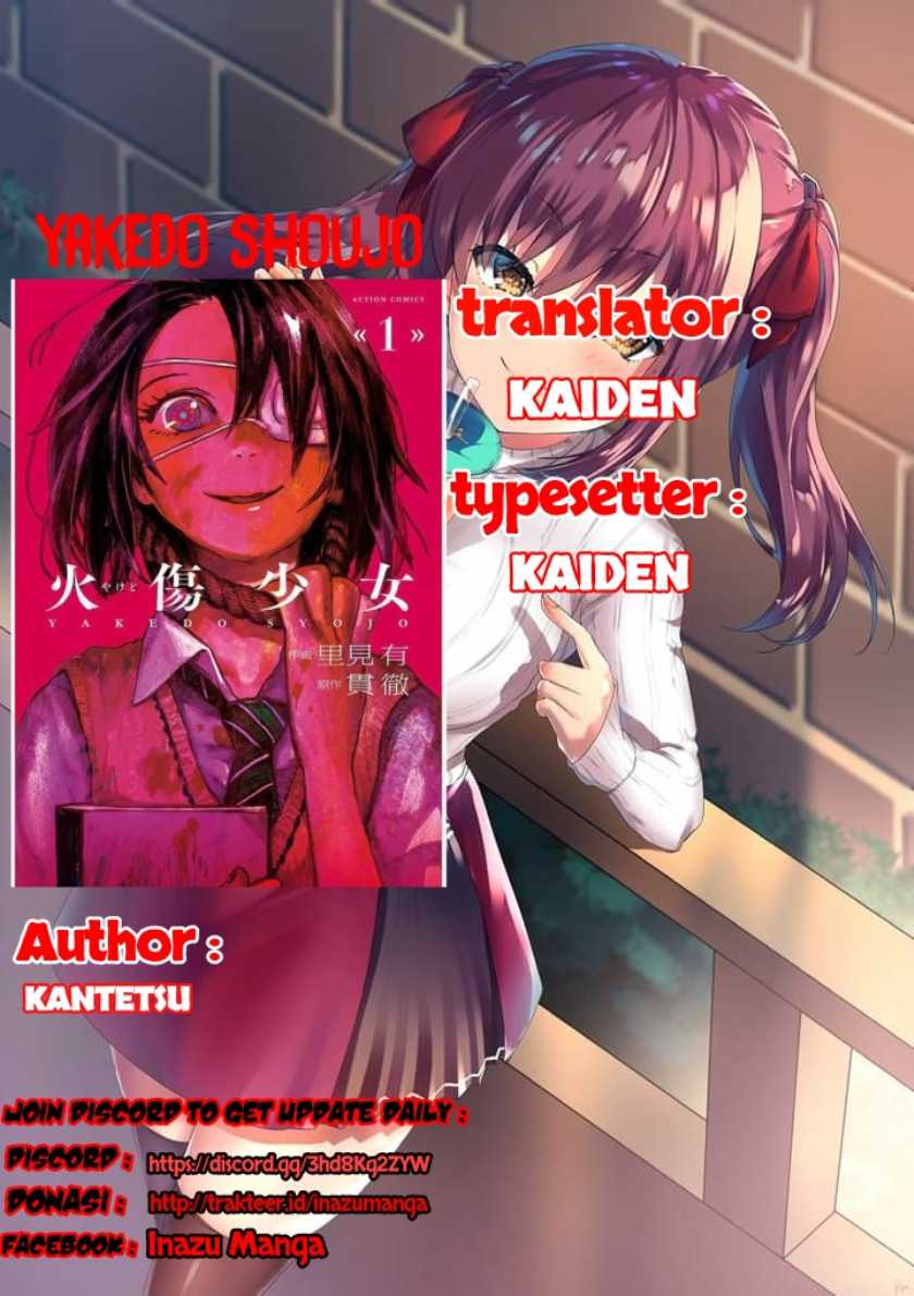 Yakedo Shoujo Bab 03 halaman 2